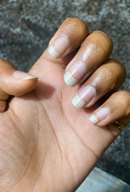 Skin & Cellular Health Reset — before