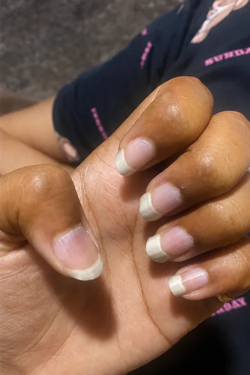 Skin & Cellular Health Reset — after