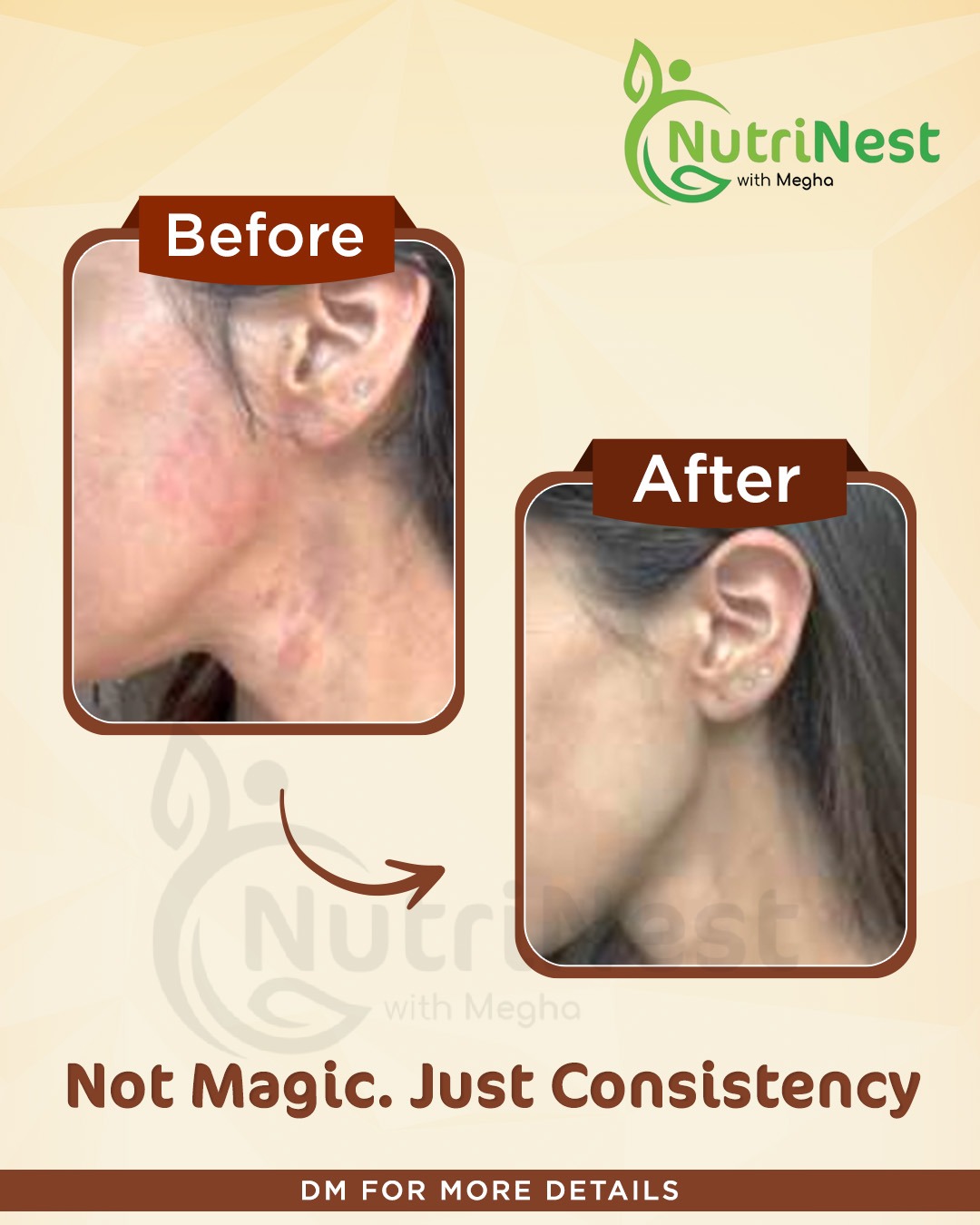 Transformation image - 2