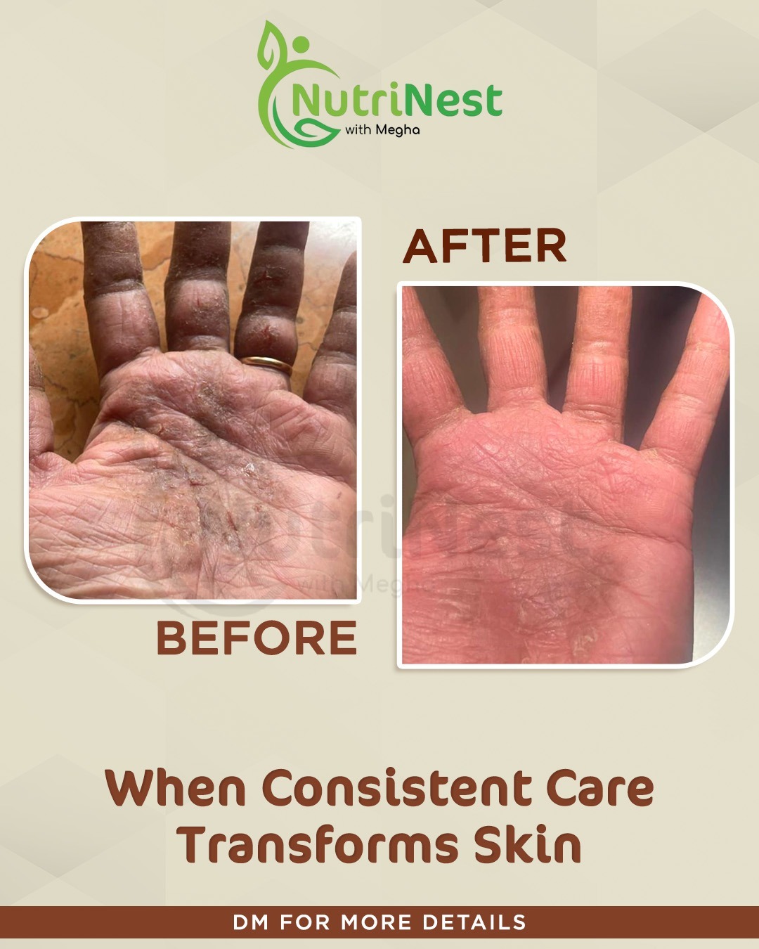 Transformation image - 5