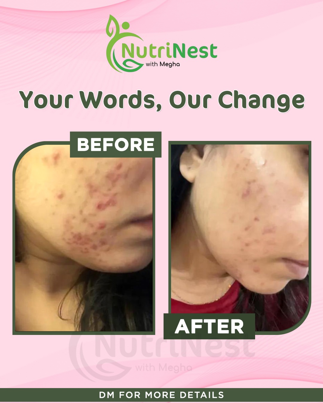 Transformation image - 8